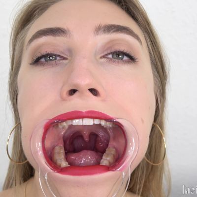 Insidemymouth